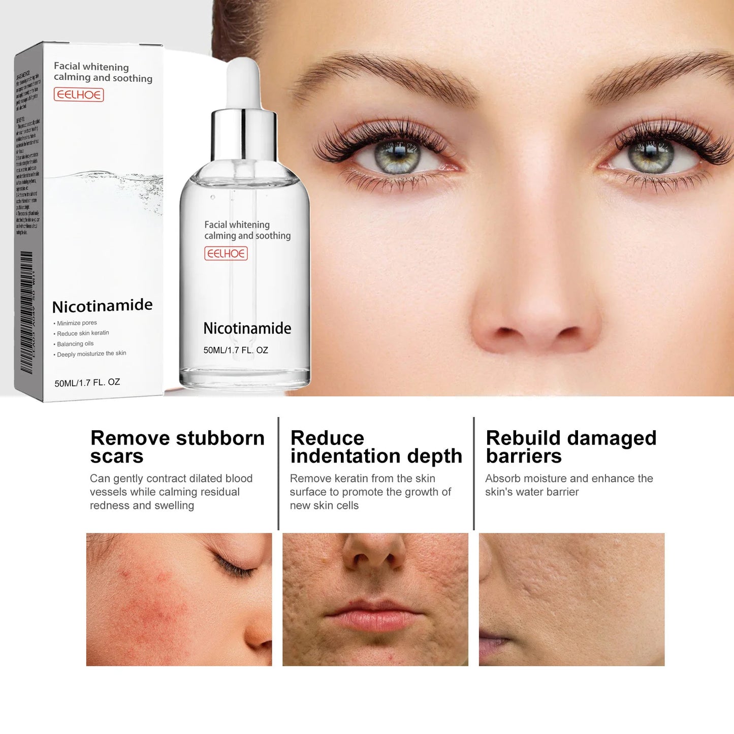 Nicotinamide Face Serum Nourish Face Contour Facial W-Hitening Shrink Pores Pigmentation Remover Skin Care Products 50Ml