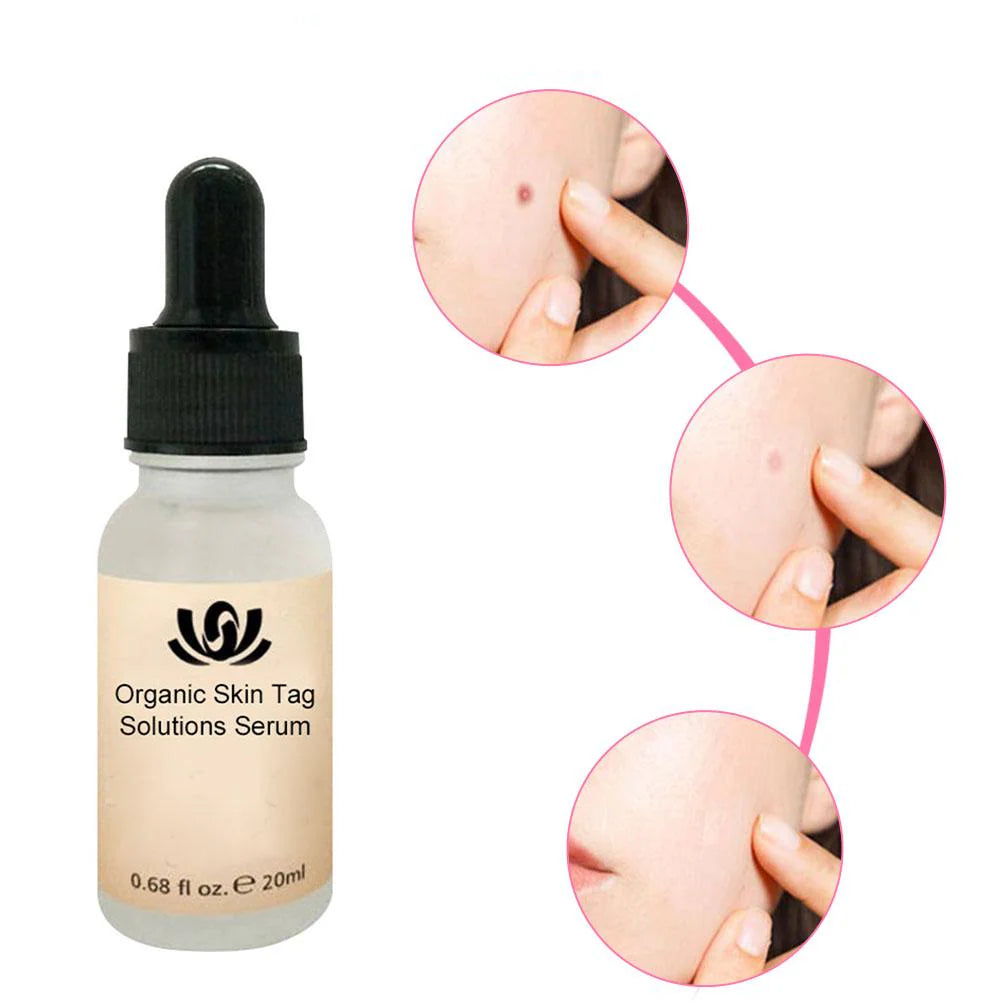 Herbcare™ Organic Serum for Skin Blemishes | Remove Unsightly Skin Spots Permanently!