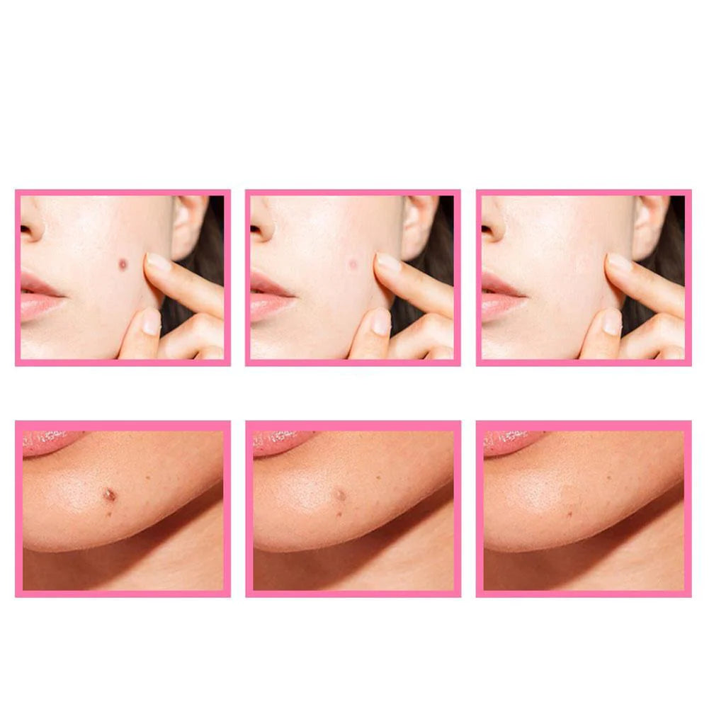 Herbcare™ Organic Serum for Skin Blemishes | Remove Unsightly Skin Spots Permanently!