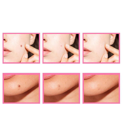 Herbcare™ Organic Serum for Skin Blemishes | Remove Unsightly Skin Spots Permanently!